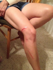 leg cut