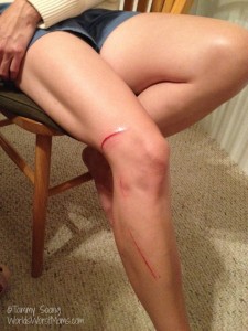 leg cut from fall through rocks on woman